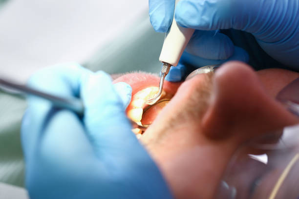 Best Emergency TMJ Treatment in Boulder Hl, IL